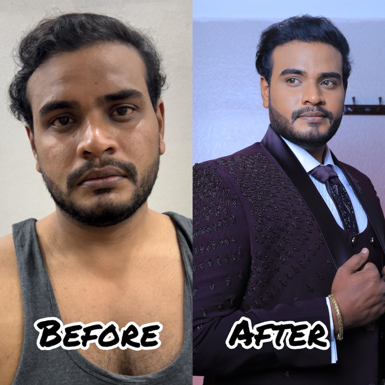 Groom Makeup Before After Chennai